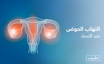 التهاب الحوض عند النساء