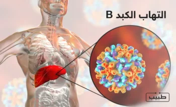 التهاب الكبد  B هو عدوى فيروسية تصيب الكبد وله العديد من المضاعفات في حال إهمال الحالة