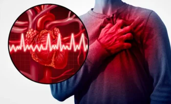 تعتبر حالة الرجفان الأذيني نوع من أنواع اضطرابات النظم القلبية