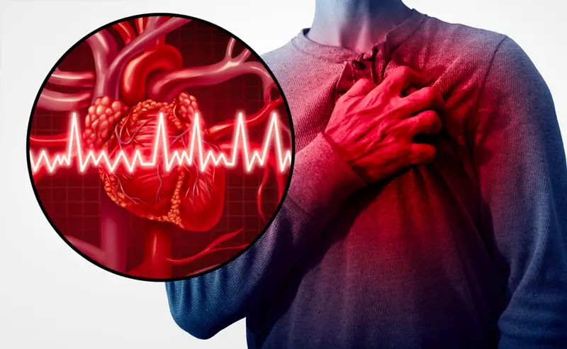 تعتبر حالة الرجفان الأذيني نوع من أنواع اضطرابات النظم القلبية