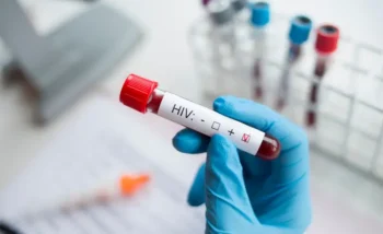 اختبار اختبار فيروس نقص المناعة البشرية من الاختبارات التشخيصية الهامة