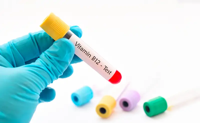 اختبار فيتامين B12 من الاختبارات الهامة وخاصة لتشخيص حالة فقر الدم