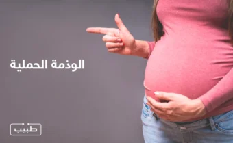 إن الوذمة الحملية هي استجابة طبيعية من الجسم للتبدلات الحاصلة خلال الحمل