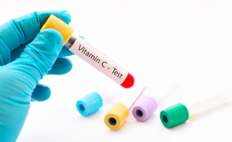 يطلب اختبار فيتامين سي في حالة الشك بوجود نقص بهذا الفيتامين في الجسم