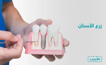 إن الالتزام بالعادات الصحية للفم والأسنان أمر أساسي، في حال قرر المريض الخضوع لعملية زراعة الأسنان