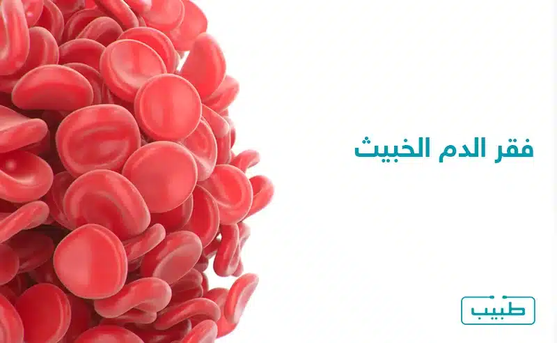 فقر الدم الخبيث هي حالة يصبح فيها عدد الكريات الحمر ذات البنية والوظيفة الطبيعية غير كاف في الجسم.