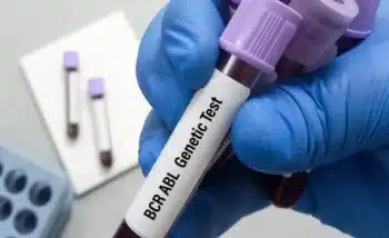 يمكن إجراء اختبار الجين BCR-ABL 1 على عينات متنوعة من الجسم مثل الدم أو نقي العظام