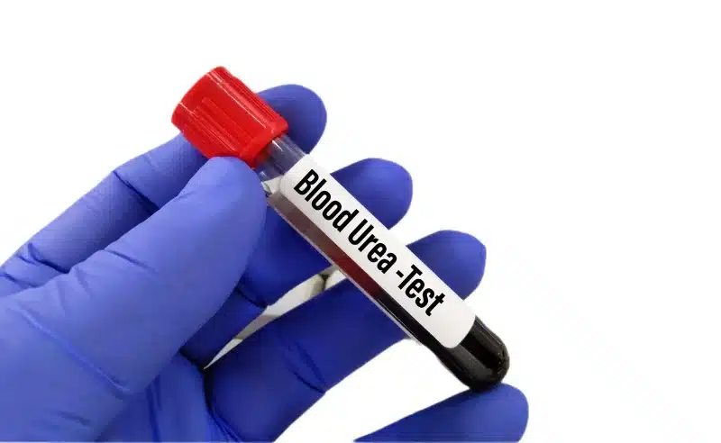 يساعد اختبار يوريا الدم في تقييم وظائف الكلى والكبد