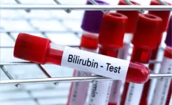 يستخدم اختبار البيليروبين الكلي لتقييم وظائف الكبد والكلى وتشخيص بعض الأمراض