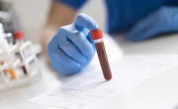يساعد اختبار الهيموغلوبين في الدم على تشخيص العديد من الأمراض مثل فقر الدم