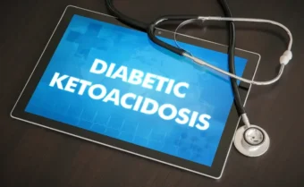 تصنف حالة الحماض الكيتوني السكري على أنها حالة اسعافية وتحتاج الرعاية الفورية للمريض