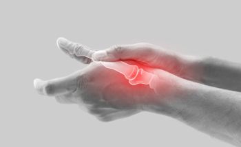 يمكن أن يسبب التهاب مفاصل الإبهام ألماً شديداً وتورماً وانخفاضاً في القوة ونطاق الحركة
