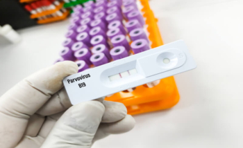 عينة اختبار PCR لفيروس البارفوفيروس B19