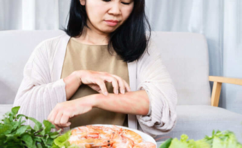 امرأة مصابة بمرض حساسية الغذاء بعد تناول نوع من الأطعمة