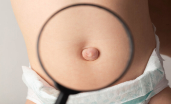 من أعراض فتق السرة عند الأطفال هو ظهور بروز في منطقة البطن